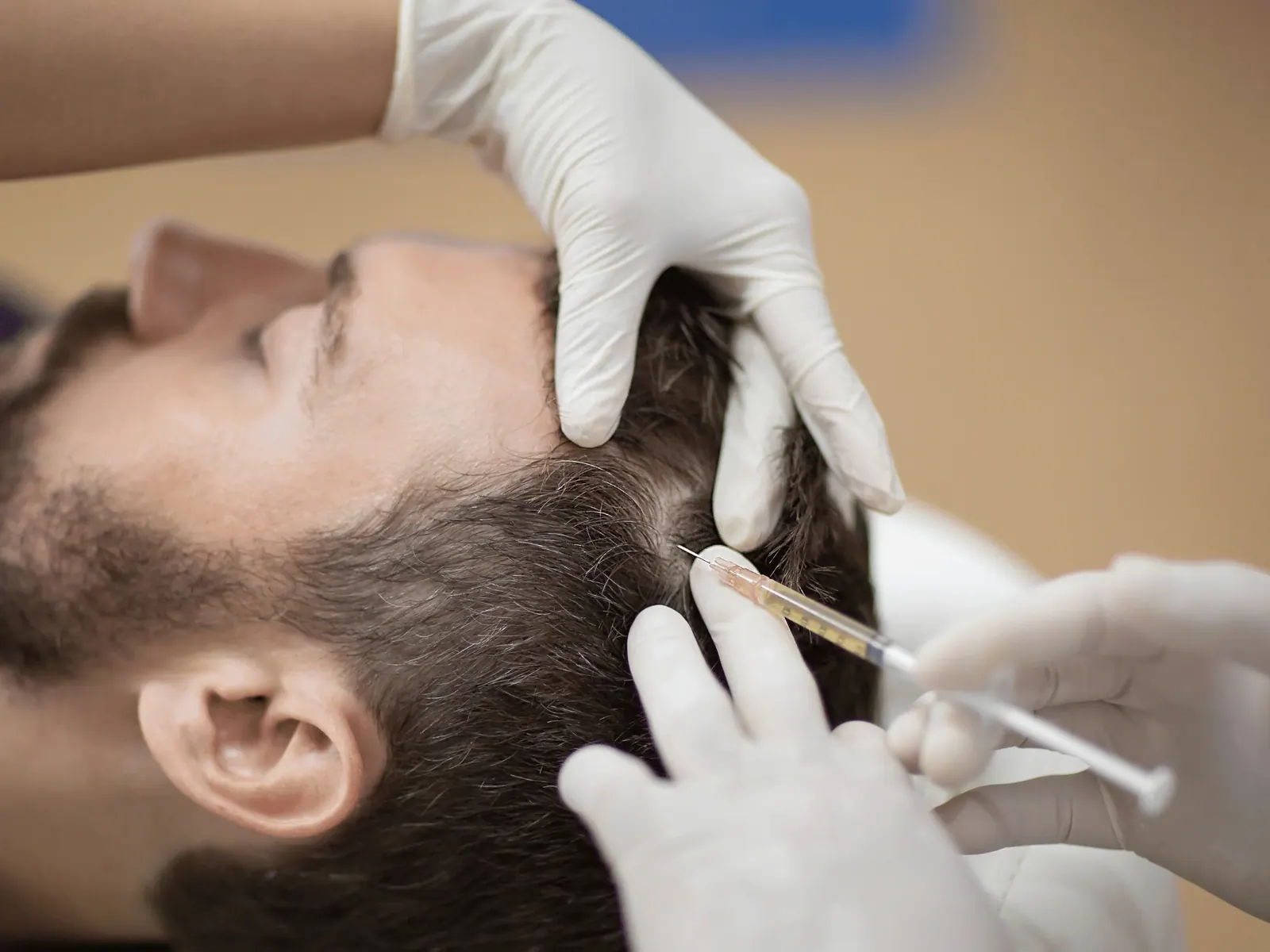 Gloved hands working near a man’s hairline
