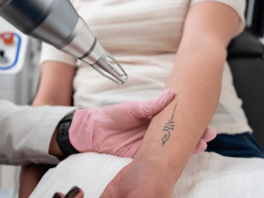 Treatment device held above a tattooed forearm