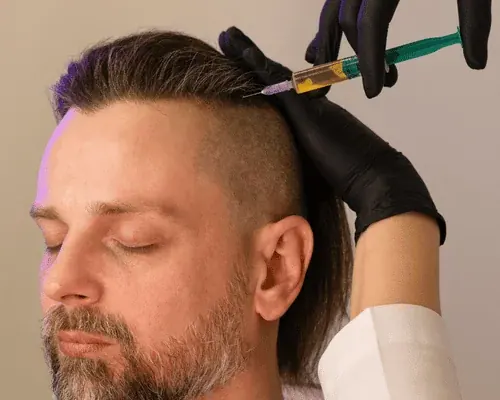 Illustration of a scalp treatment