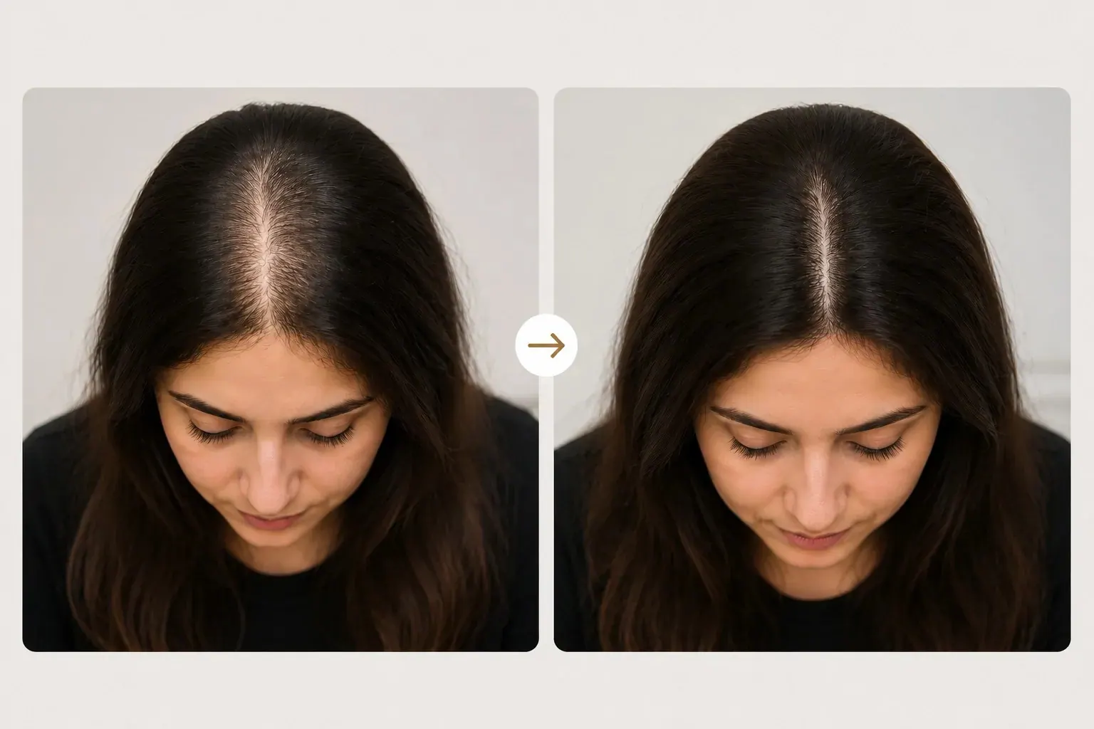 Side-by-side views of a woman’s hair parting