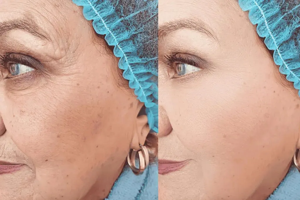 Side-by-side portraits of a woman wearing a surgical cap