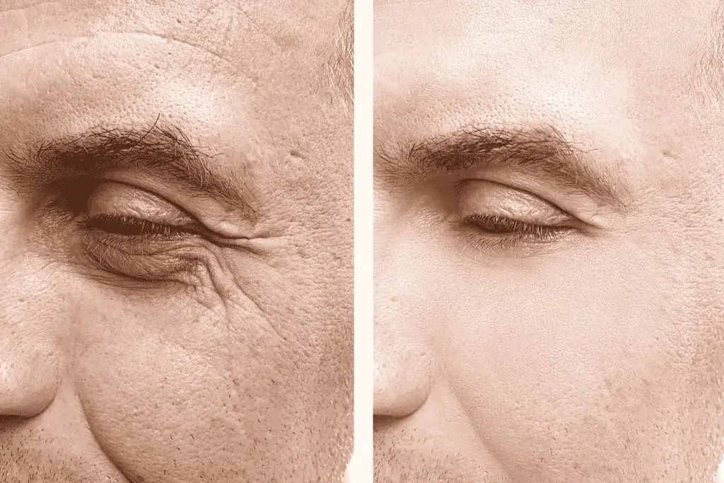 Side-by-side close-ups of the eye area