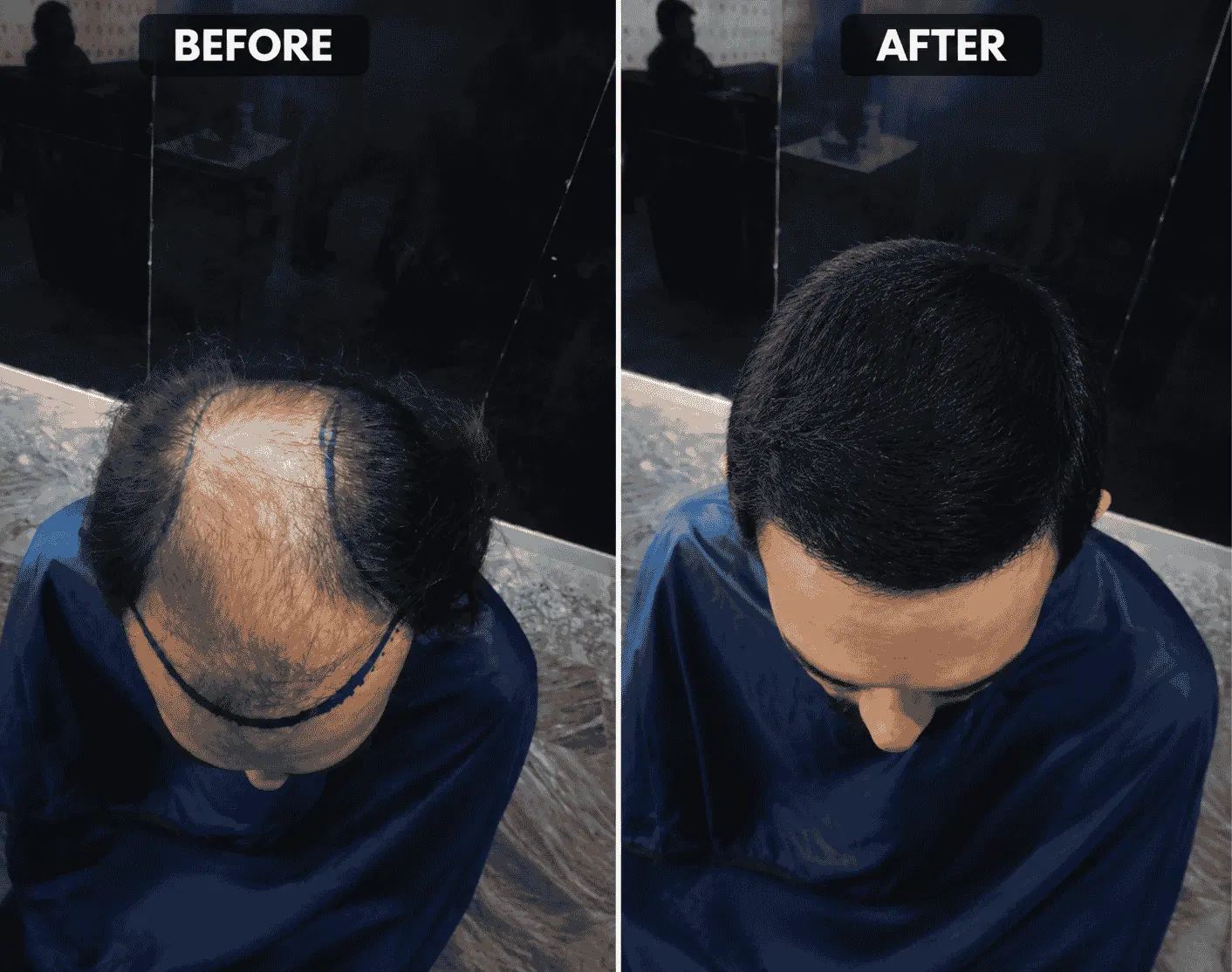 Side-by-side views of a man’s scalp